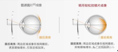 成人视力调节镜使用视频,轻松掌握成人视力调节镜使用技巧